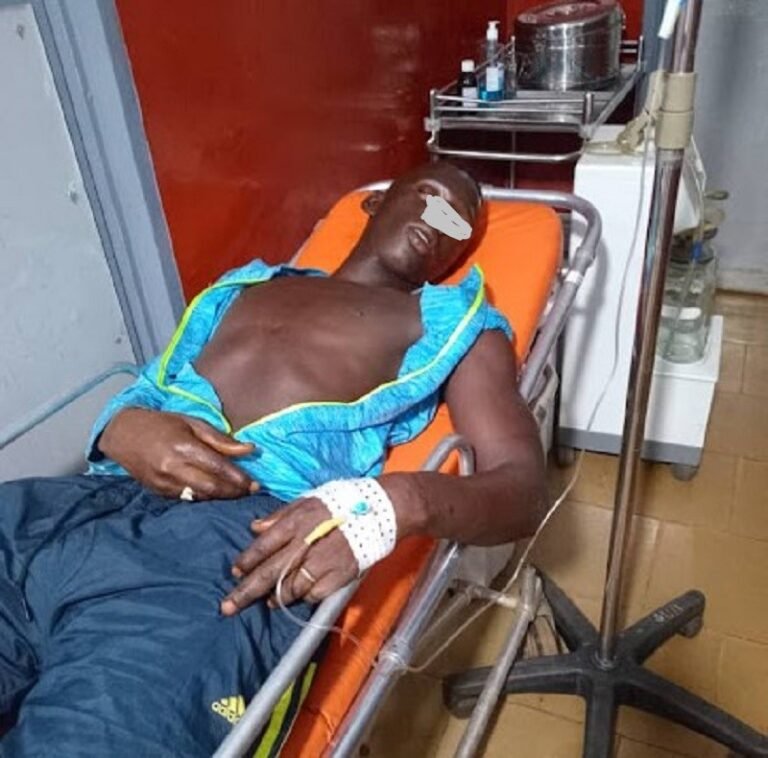 Conakry/Tombolia : Pris pour un voleur, un jeune laveur de véhicules battu et ligoté dans un garage d’automobiles